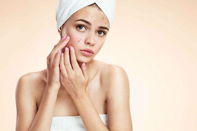 Top 7+ sữa rửa mặt hỗ trợ làm sạch mụn cho da dầu được nhiều khách hàng yêu thích làm sạch hiệu quả và thân thiện với làn da - 1