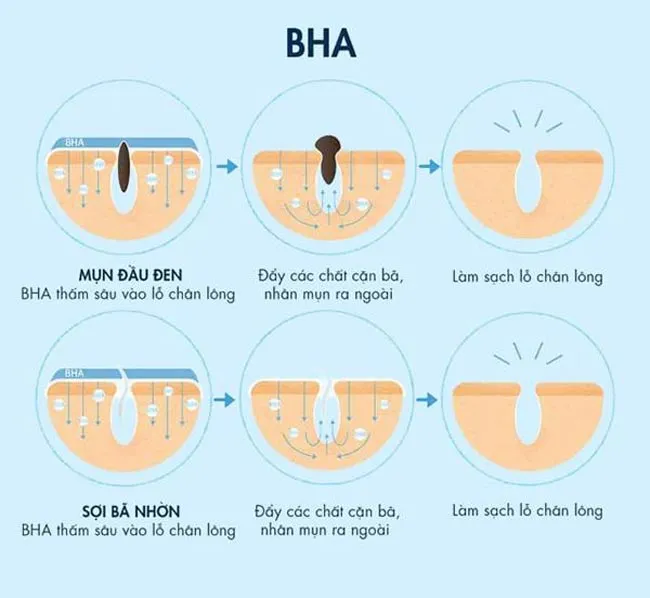 Cách dùng BHA Obagi hiệu quả trong quy trình chăm sóc da dầu mụn