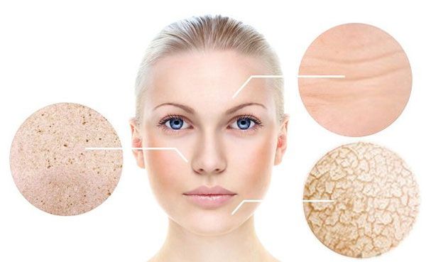 Da khô là gì? Dấu hiệu nhận biết và cách chọn mỹ phẩm cho da khô uy tín