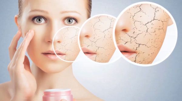 Da khô là gì? Dấu hiệu nhận biết và cách chọn mỹ phẩm cho da khô uy tín