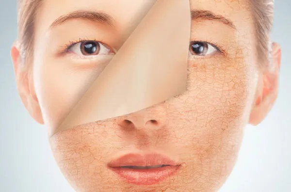 Hyaluronic Acid là gì? Hyaluronic Acid có tác dụng dụng gì trong làm đẹp?