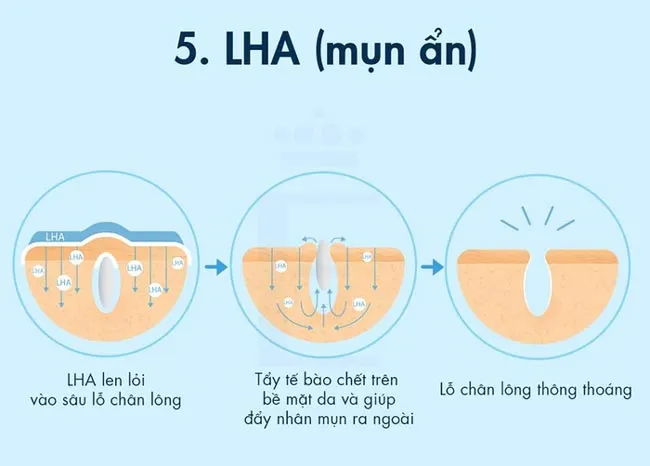 LHA là gì? Công dụng và cách dùng LHA trong làm đẹp