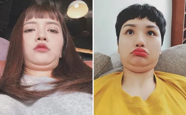 Nọng cằm là gì? Hướng dẫn 4 cách giảm nọng cằm tại nhà nhanh chỉ sau 1 tuần