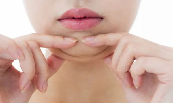 Nọng cằm là gì? Hướng dẫn 4 cách giảm nọng cằm tại nhà nhanh chỉ sau 1 tuần