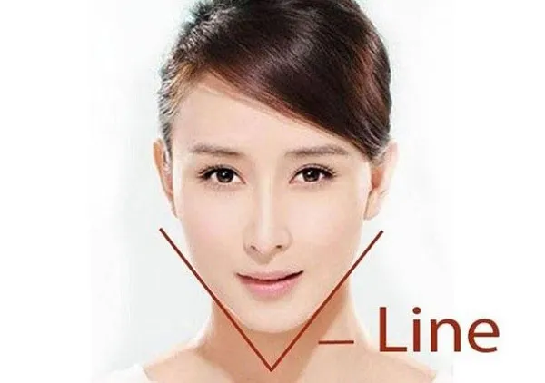 Nọng cằm là gì? Hướng dẫn 4 cách giảm nọng cằm tại nhà nhanh chỉ sau 1 tuần