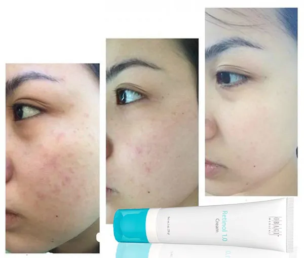 Combo Máy Rửa Mặt Foreo Luna Mini 3 Màu Hồng Nhạt + Toner Và Kem Dưỡng Da Obagi - Máy rửa mặt - Vua Hàng Hiệu