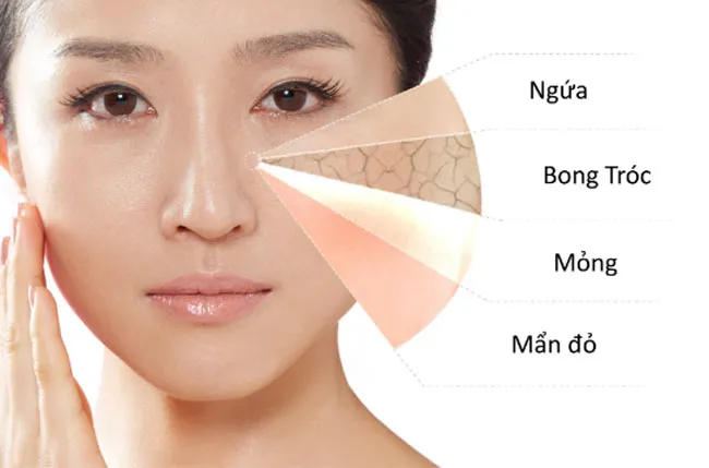 Review 11 loại sữa rửa mặt cho da nhạy cảm và mụn dịu nhẹ lành tính chất lượng tốt - 1