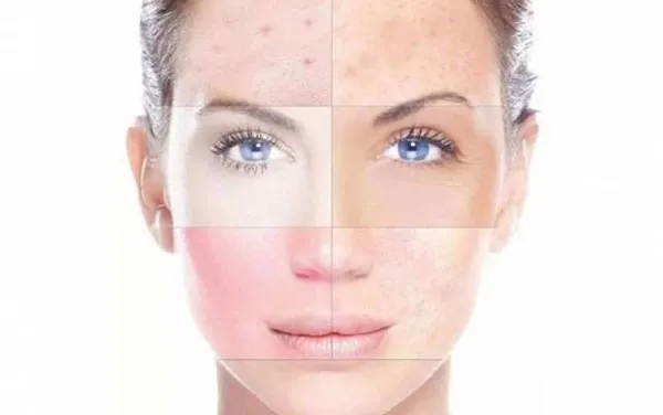 Top 11 kem dưỡng ẩm phục hồi hư tổn cho da tại nhà hiệu quả tốc độ vượt trội - 1