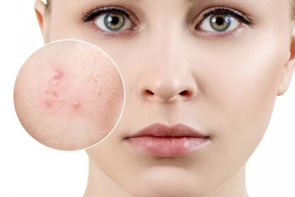 Top 11 kem dưỡng ẩm phục hồi hư tổn cho da tại nhà hiệu quả tốc độ vượt trội - 3