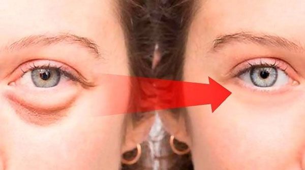 Top 7 kem dưỡng mắt Hàn Quốc ngừa lão hóa và giảm bọng mắt hiệu quả - 17