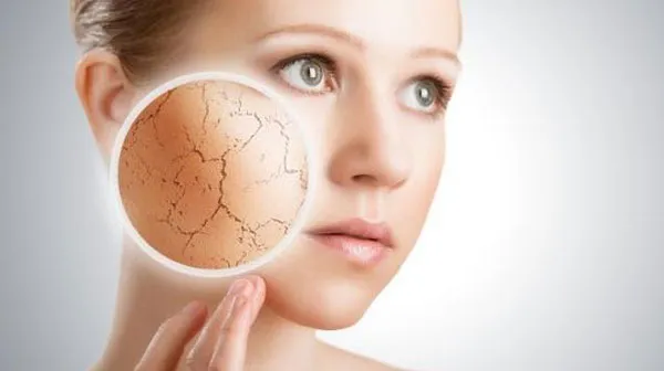 Da khô nên chọn mặt nạ gì? Top 9+ mặt nạ dành cho da khô giúp da căng mướt
