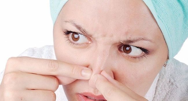 Mụn cám là gì? Top 5 sản phẩm trị sạch mụn cám thân thiện với làn da và nhanh chóng