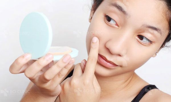Benzoyl Peroxide là gì? Dùng Benzoyl Peroxide hỗ trợ làm sạch mụn có thực sự tốt hay không?