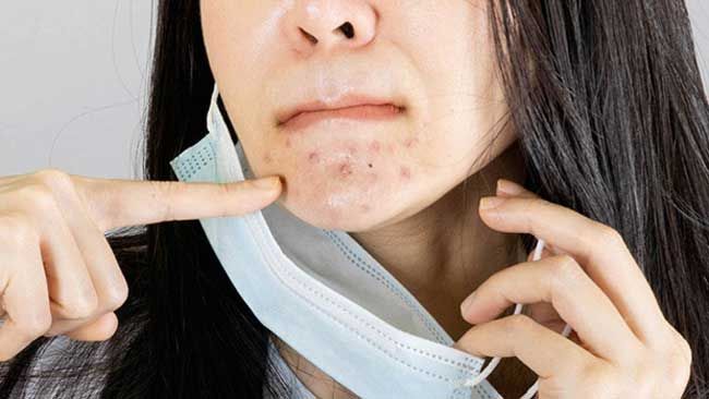 6 mẹo chăm sóc da mặt khi đeo khẩu trang thường xuyên