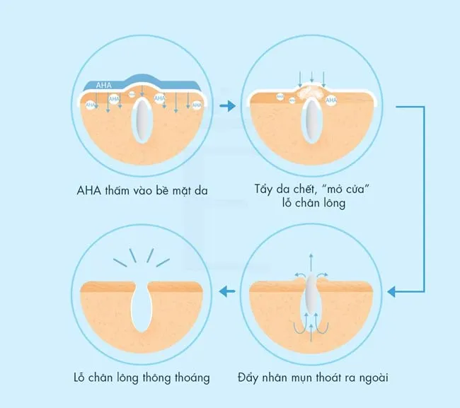 Cách kết hợp BHA và AHA trong quy trình dưỡng da thân thiện với làn da hiệu quả