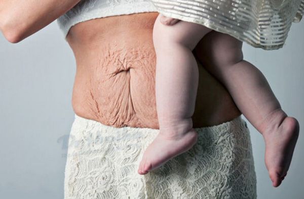 9 Cách chăm sóc da sau sinh rất đơn giản có thể thực hiện tại nhà