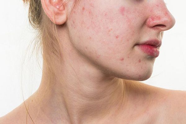 9 Cách chăm sóc da sau sinh rất đơn giản có thể thực hiện tại nhà