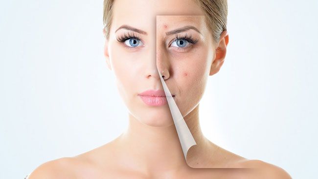 BHA là gì? Cách sử dụng BHA đúng cách (Từng Bước đẹp da)
