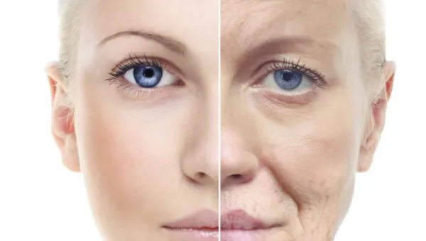 Elastin là gì? Hướng dẫn cách bổ sung Elastin cho làn da đúng cách - 4