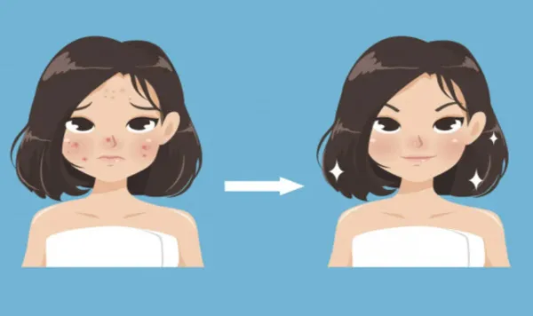 Công dụng và cách dùng Pro-retinol cho người mới bắt đầu