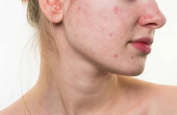 Công dụng và cách dùng Pro-retinol cho người mới bắt đầu