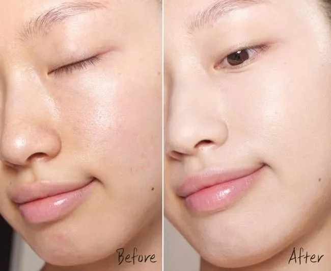 [REVIEW] Toner Obagi Clenziderm MD Pore Therapy có tốt không? - 8