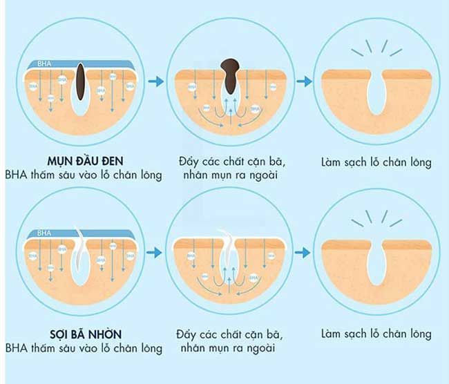 Salicylic acid là gì? Công dụng và cách dùng trong làm đẹp
