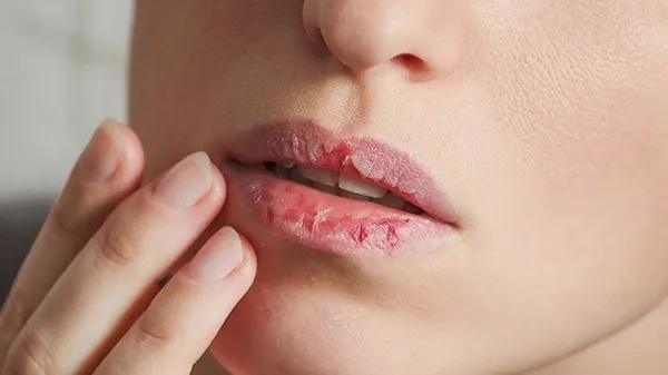 Review bảng màu son cho môi thâm che khuyết điểm tốt lên màu tươi tắn