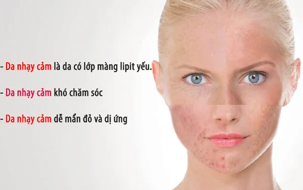 Top 8 toner cho da nhạy cảm dưỡng da khỏe mạnh và căng bóng