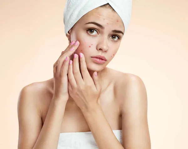 Top 11 bộ sản phẩm skincare cho da dầu mụn hiệu quả và thân thiện với làn da