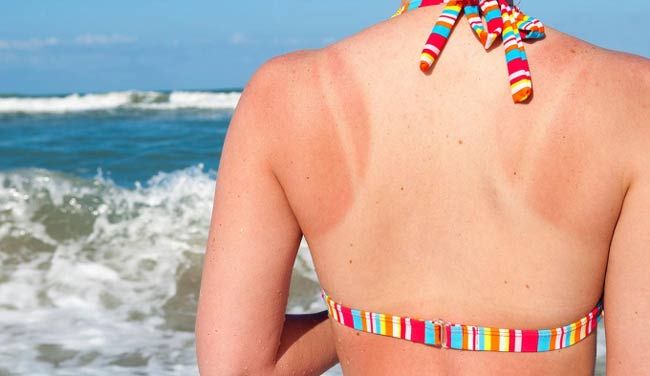 10 biện pháp bảo vệ da cải thiện ánh nắng mặt trời mà bạn cần biết