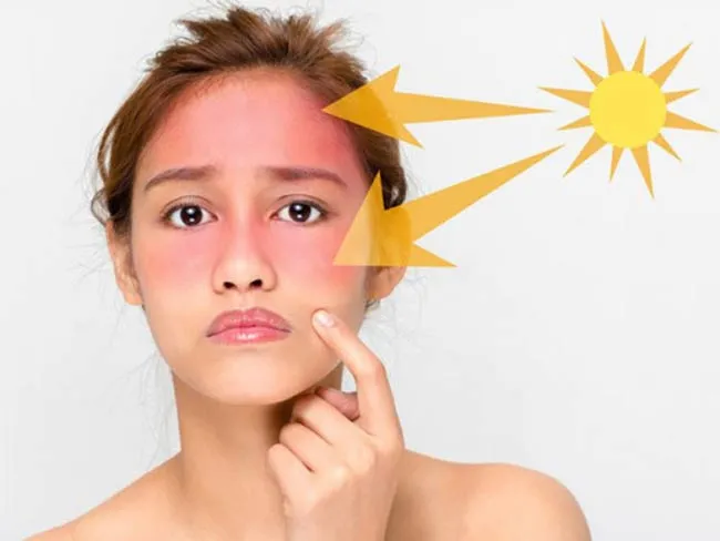 10 biện pháp bảo vệ da cải thiện ánh nắng mặt trời mà bạn cần biết