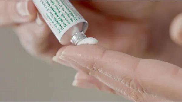 Da bị nhiễm corticoid là gì? 7 cách phục hồi da nhiễm corticoid từ nhẹ đến nặng