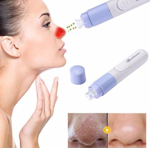 6 bước sử dụng máy hút mụn tại nhà đơn giản và không tổn thương da