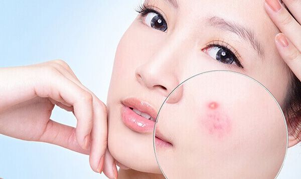 6 bước sử dụng máy hút mụn tại nhà đơn giản và không tổn thương da