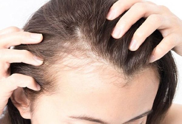 Review 7 dầu gội trị rụng tóc hiệu quả kích thích mọc tóc tốc độ vượt trội