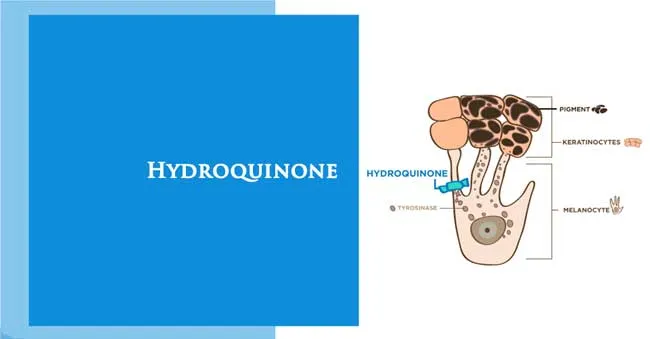 Hydroquinone là gì? Top 5 sản phẩm Hydroquinone trị nám dưỡng trắng da chất lượng tốt