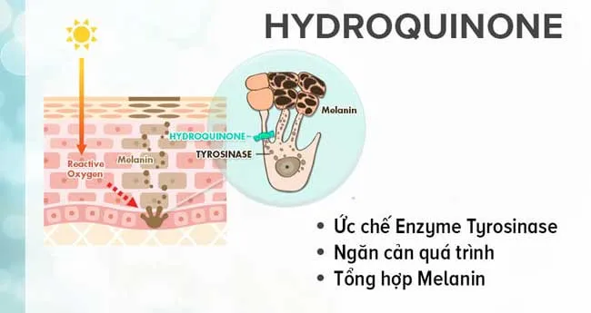 Hydroquinone là gì? Top 5 sản phẩm Hydroquinone trị nám dưỡng trắng da chất lượng tốt