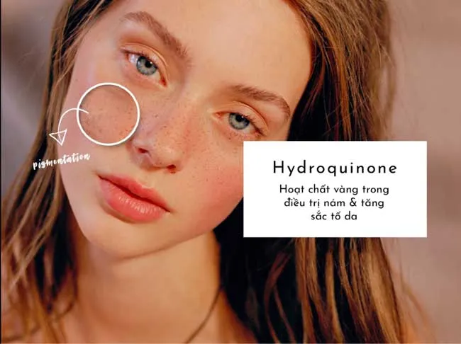 Hydroquinone là gì? Top 5 sản phẩm Hydroquinone trị nám dưỡng trắng da chất lượng tốt