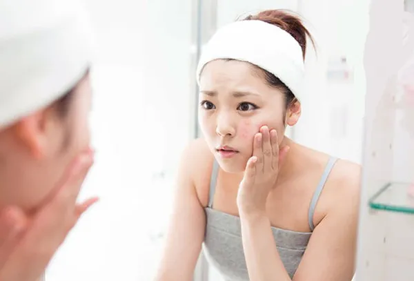 kem hỗ trợ làm sạch mụn tuổi dậy thì nữ 1