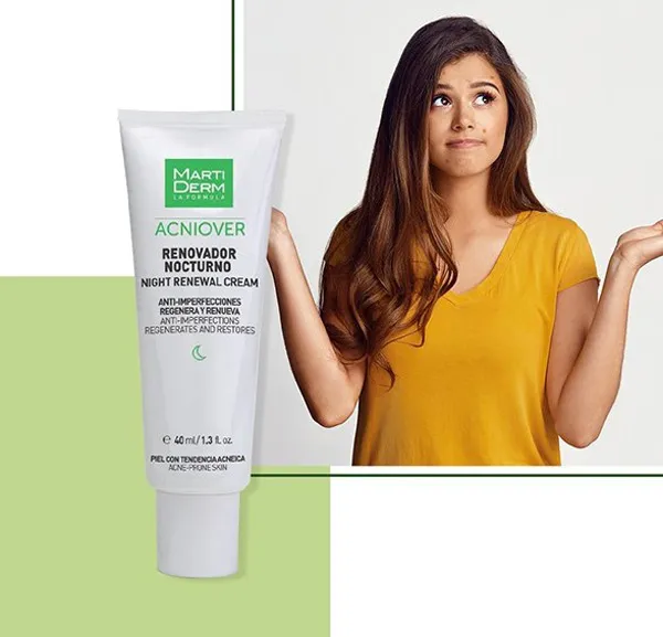 kem hỗ trợ làm sạch mụn tuổi dậy thì nữ 17