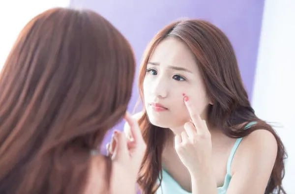 kem hỗ trợ làm sạch mụn tuổi dậy thì nữ 18