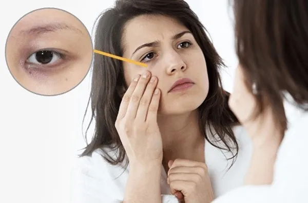 Top 13 kem trị thâm mắt được nhiều khách hàng yêu thích được nhiều người ưa chuộng