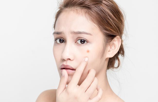 Làm sao để có làn da đẹp không mụn? 10 mẹo chăm sóc da sạch mụn mịn màng