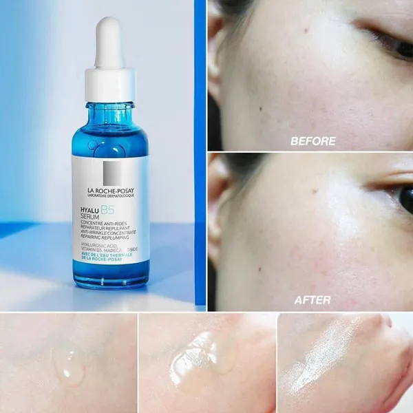 Đánh giá chi tiết Serum B5 La Roche-Posay tái tạo và phục hồi da có tốt không