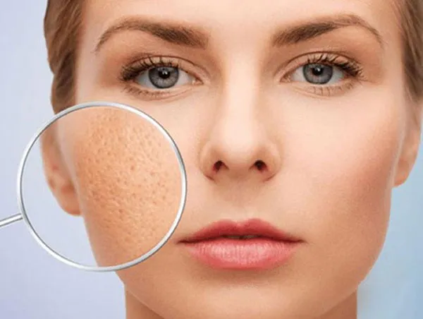 Top 15 sữa rửa mặt hỗ trợ làm sạch mụn chất lượng tốt dùng hiệu quả cho mọi loại da - 4