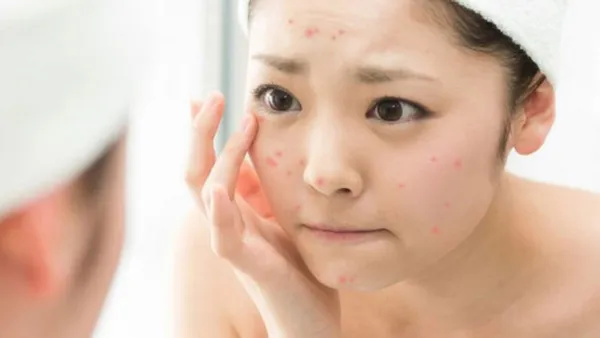 Top 14 sữa rửa mặt trị thâm hiệu quả giúp làm đều màu da