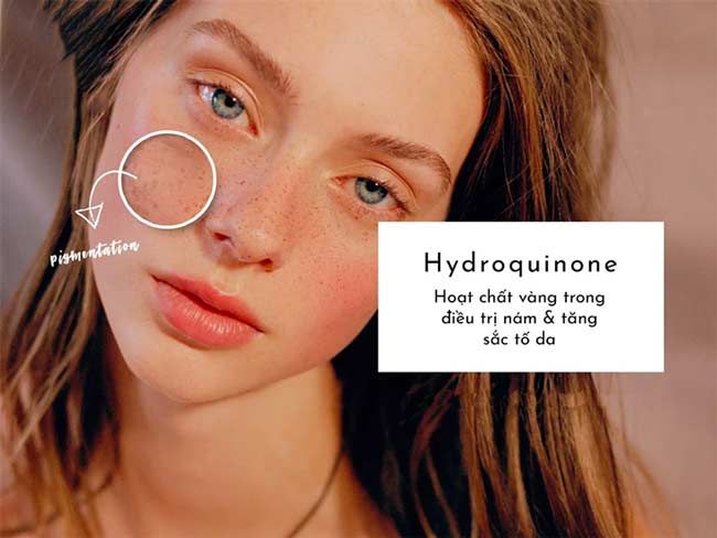 Treatment là gì? 7 loại Treatment dưỡng da chất lượng tốt được dùng nhiều hiện nay