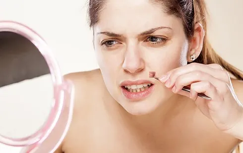 10 cách nhận diện các loại mụn trên khuôn mặt bạn nên biết