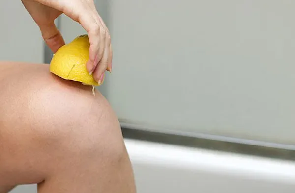 Phương pháp trị thâm đầu gối và khuỷu tay cho nữ tại nhà hiệu quả